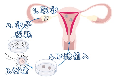 妇科